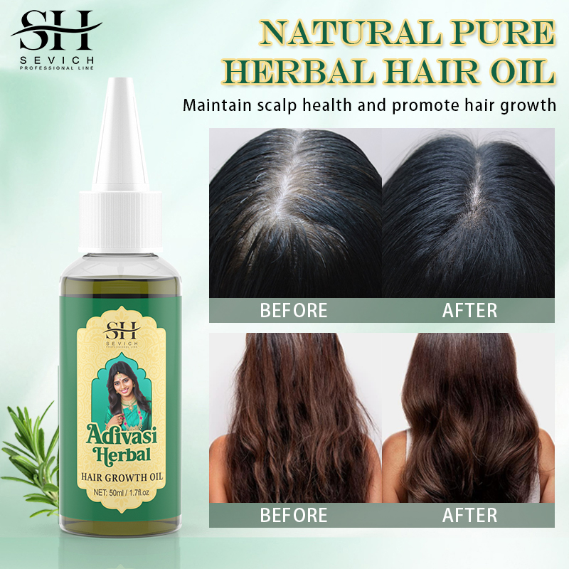 Ayurvedic Hair Growth Oil Adiv - مراجعة Coconut Oil Refined وسعره